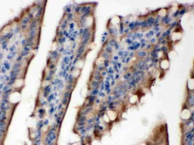 2 - Anti-SULT2B1 Picoband Antibody ABO12508