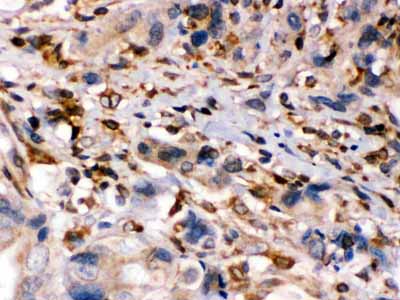 2 - Anti-TAP1 Picoband Antibody ABO12509