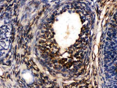 2 - Anti-TCP1 Alpha Picoband Antibody ABO12512