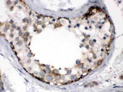 2 - Anti-TCP1 Alpha Picoband Antibody ABO12512