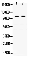 1 - Anti-Transferrin Picoband Antibody ABO12513