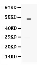 1 - Anti-TGFBR1 Picoband Antibody ABO12514