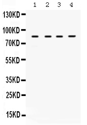 1 - Anti-TGFBR2 Picoband Antibody ABO12515