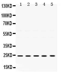 1 - Anti-TIMP-2 Antibody ABO12516