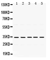 1 - Anti-TIMP-3 Antibody ABO12517