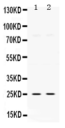 1 - Anti-TK1 Picoband Antibody ABO12518