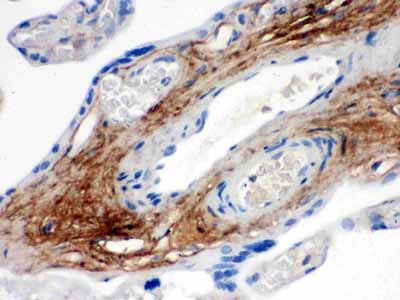 2 - Anti-TNXB Picoband Antibody ABO12519