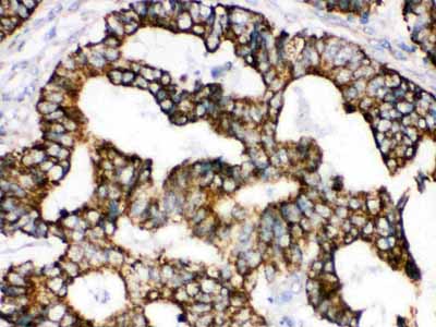 2 - Anti-TRAP1 Picoband Antibody ABO12520