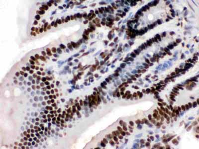 2 - Anti-KAP1 Picoband Antibody ABO12521