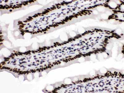 2 - Anti-KAP1 Picoband Antibody ABO12521