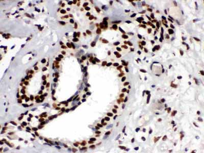 2 - Anti-KAP1 Picoband Antibody ABO12521
