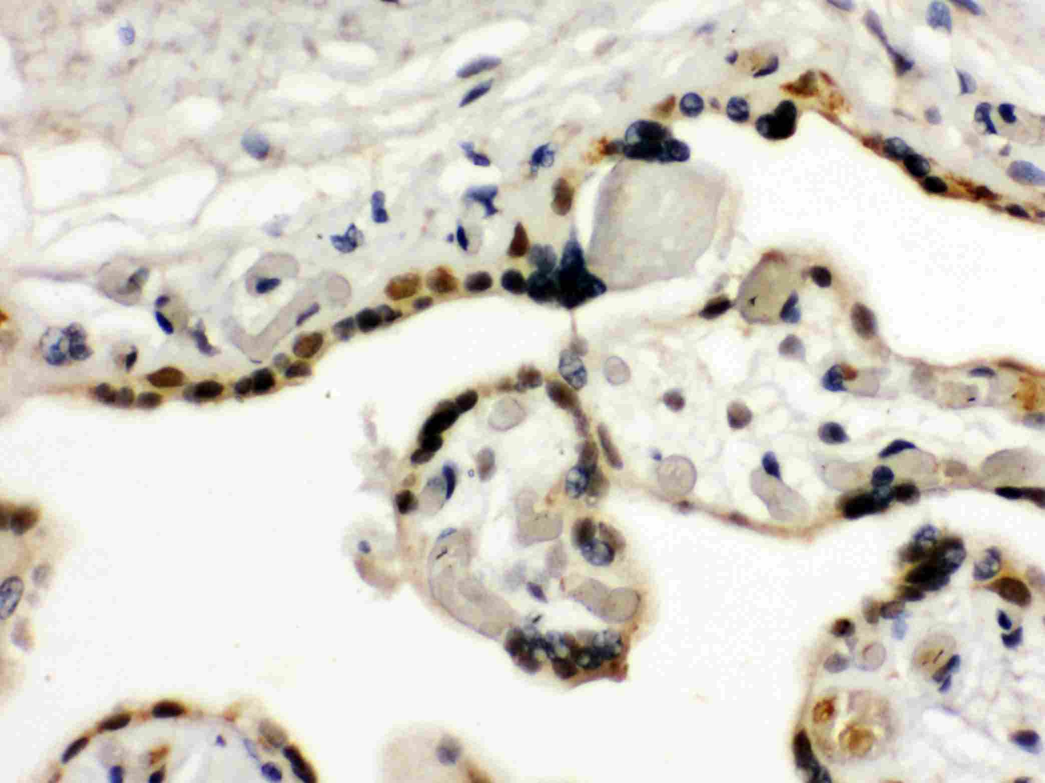 2 - Anti-TIF1 Gamma Picoband Antibody ABO12522
