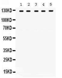1 - Anti-TRPM8 Picoband Antibody ABO12523