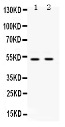 1 - Anti-UBE1C Picoband Antibody ABO12524