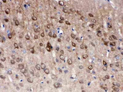 2 - Anti-PGP9.5 Picoband Antibody ABO12526