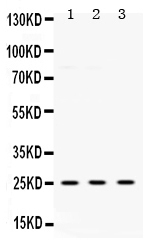 1 - Anti-PGP9.5 Picoband Antibody ABO12526