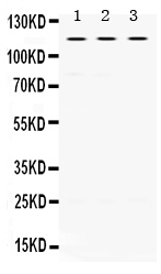 1 - Anti-UNC5C Picoband Antibody ABO12527