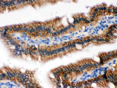 2 - Anti-RENT1/hUPF1 Picoband Antibody ABO12528