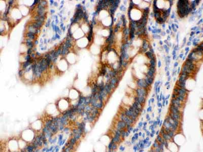 2 - Anti-RENT1/hUPF1 Picoband Antibody ABO12528
