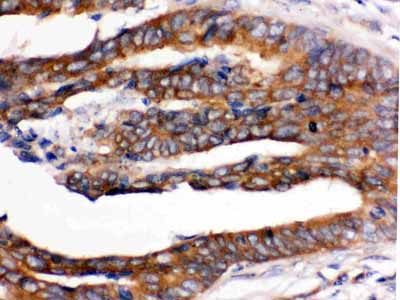 2 - Anti-RENT1/hUPF1 Picoband Antibody ABO12528