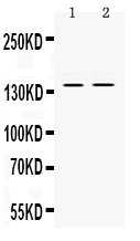 1 - Anti-RENT1/hUPF1 Picoband Antibody ABO12528