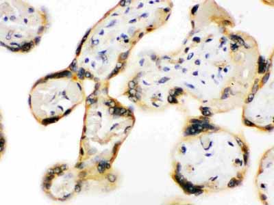 2 - Anti-UPF3B/RENT3B Picoband Antibody ABO12529