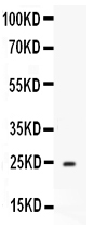 1 - Anti-APOA1 Antibody ABO12530