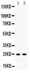 1 - Anti-APOA1 Antibody ABO12531