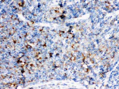2 - Anti-CD14 Picoband Antibody ABO12533