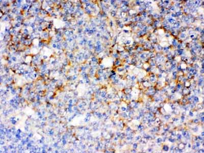 2 - Anti-CD14 Picoband Antibody ABO12533