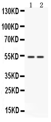1 - Anti-CD14 Picoband Antibody ABO12533