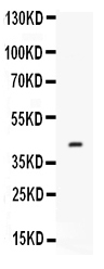 1 - Anti-CFD Antibody ABO12536