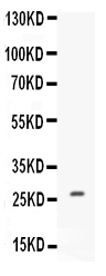 1 - Anti-CNTF Picoband Antibody ABO12537