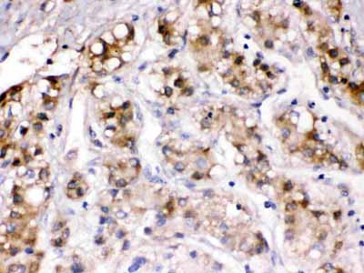 2 - Anti-Ceruloplasmin Picoband Antibody ABO12538