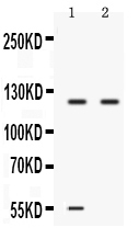 1 - Anti-Ceruloplasmin Picoband Antibody ABO12538