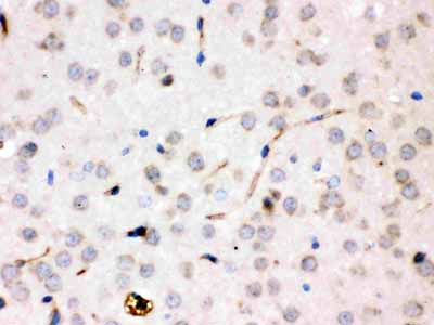 2 - Anti-Ceruloplasmin Picoband Antibody ABO12539