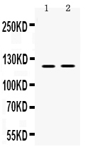 1 - Anti-Ceruloplasmin Picoband Antibody ABO12539