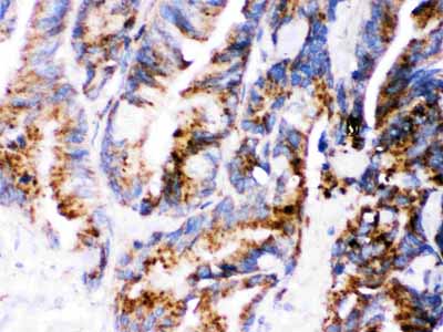 2 - Anti-Cathepsin D Picoband Antibody ABO12540