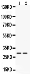 1 - Anti-Cathepsin G Picoband Antibody ABO12541
