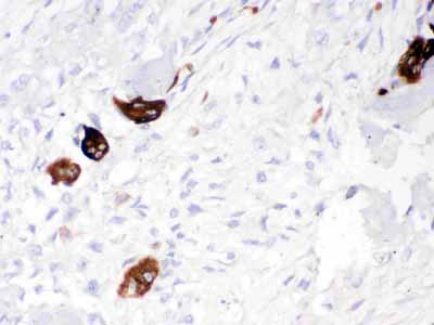 2 - Anti-Cathepsin K Picoband Antibody ABO12542