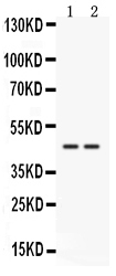 1 - Anti-Cathepsin K Picoband Antibody ABO12542