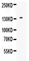 1 - Anti-EGF Picoband Antibody ABO12547