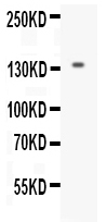 1 - Anti-EGF Picoband Antibody ABO12548