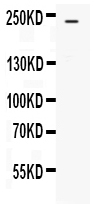 1 - Anti-EGFR Picoband Antibody ABO12549