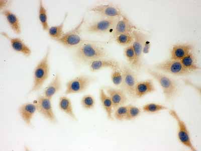 2 - Anti-FASN Picoband Antibody ABO12551