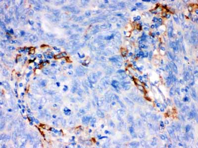 2 - Anti-FCRN/FCGRT Picoband Antibody ABO12552