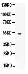 1 - Anti-FCRN/FCGRT Picoband Antibody ABO12552