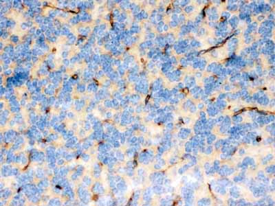 2 - Anti-FCRN/FCGRT Picoband Antibody ABO12553