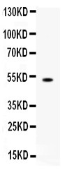 1 - Anti-FCRN/FCGRT Picoband Antibody ABO12553