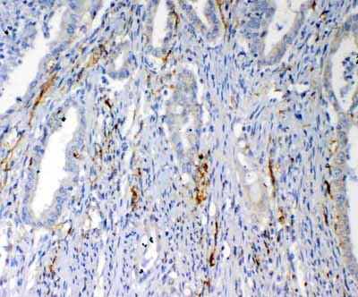 2 - Anti-VEGFD Picoband Antibody ABO12555